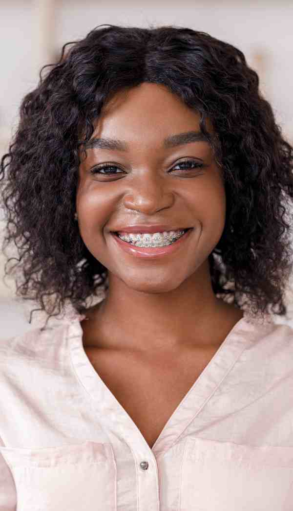 teeth alignment braces