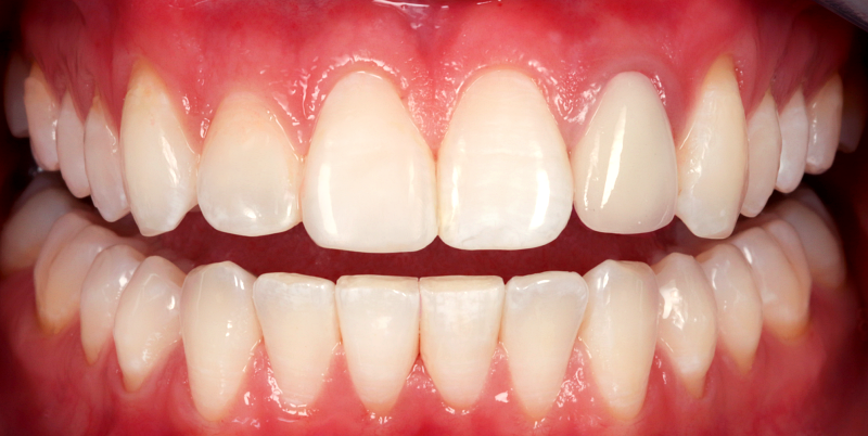 After -Chatham Dental