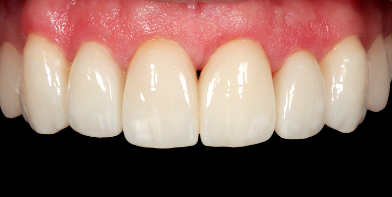 After -Chatham Dental