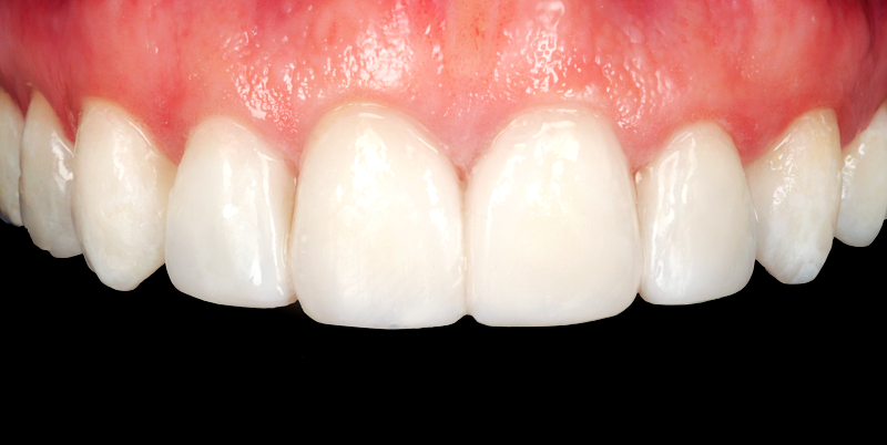 After -Chatham Dental