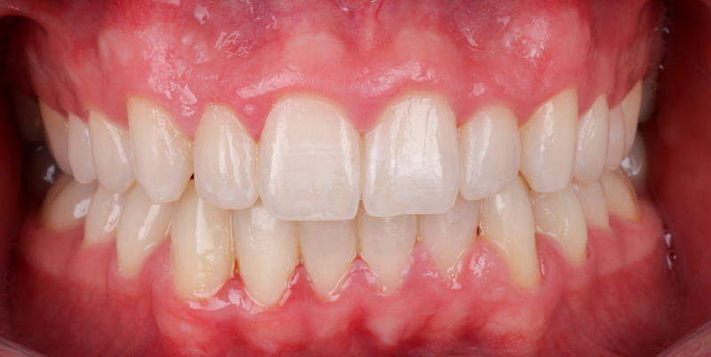 After -Chatham Dental