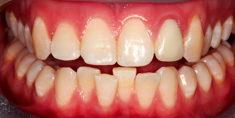 Before - Chatham Dental