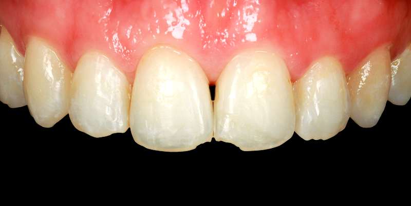 Before - Chatham Dental