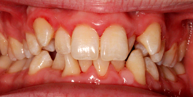 Before - Chatham Dental