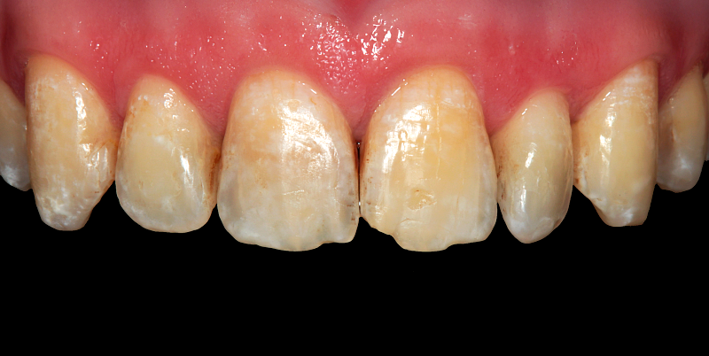 Before - Chatham Dental