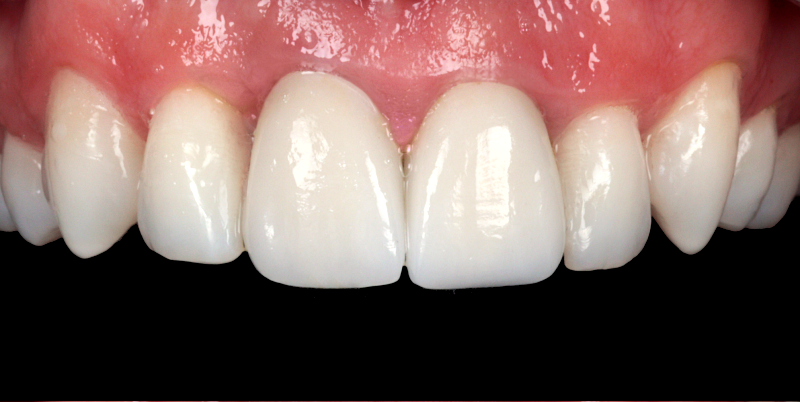 After -Chatham Dental