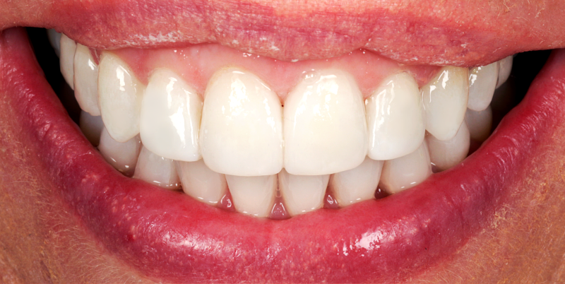 After -Chatham Dental