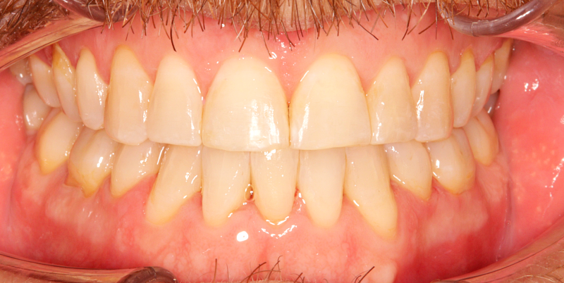 After -Chatham Dental