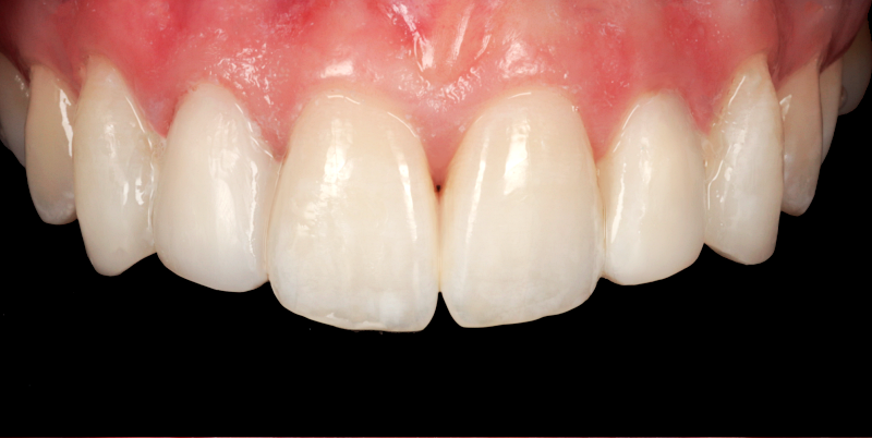 After -Chatham Dental