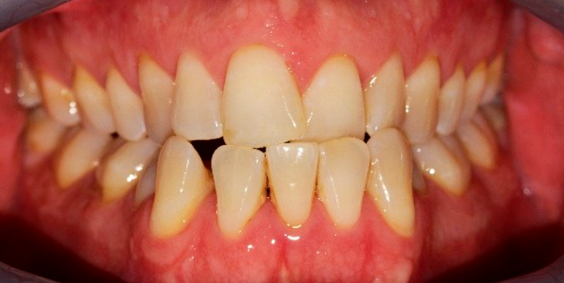 Before - Chatham Dental