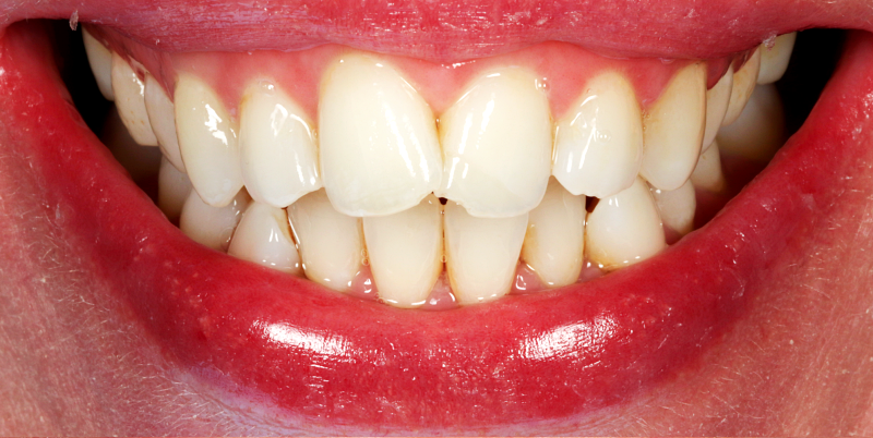 Before - Chatham Dental