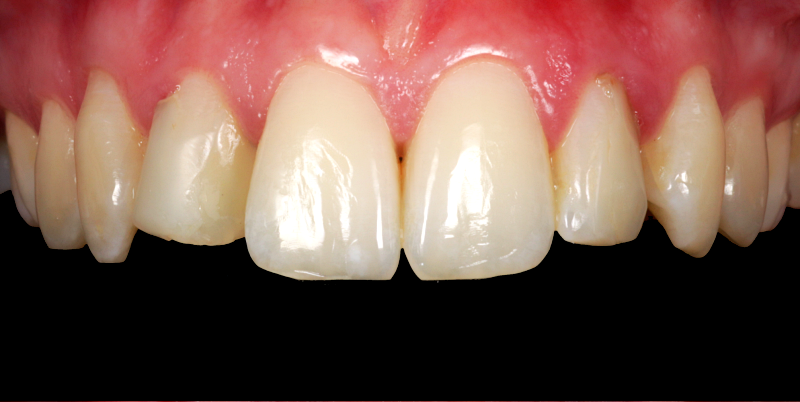 Before - Chatham Dental