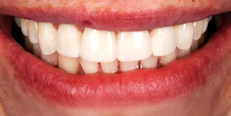 After -Chatham Dental