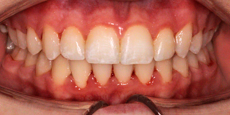 After -Chatham Dental