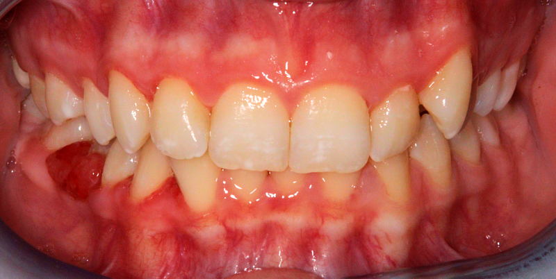 Before - Chatham Dental