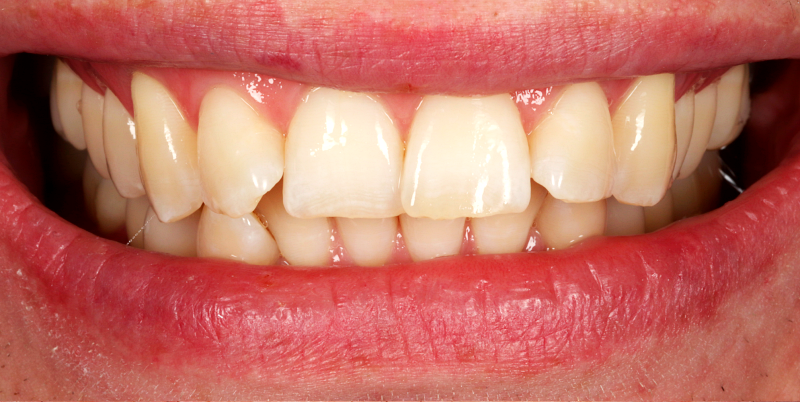 Before - Chatham Dental