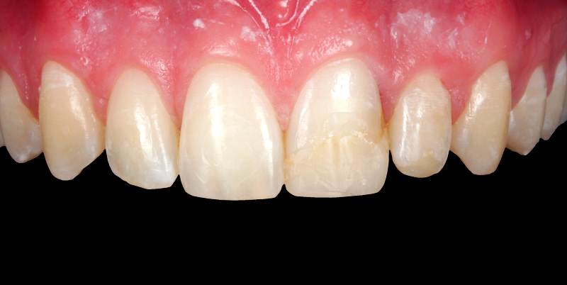 Before - Chatham Dental