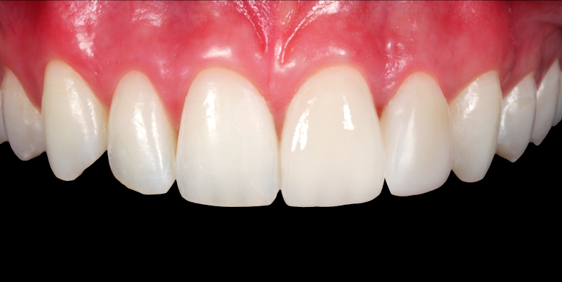 After -Chatham Dental