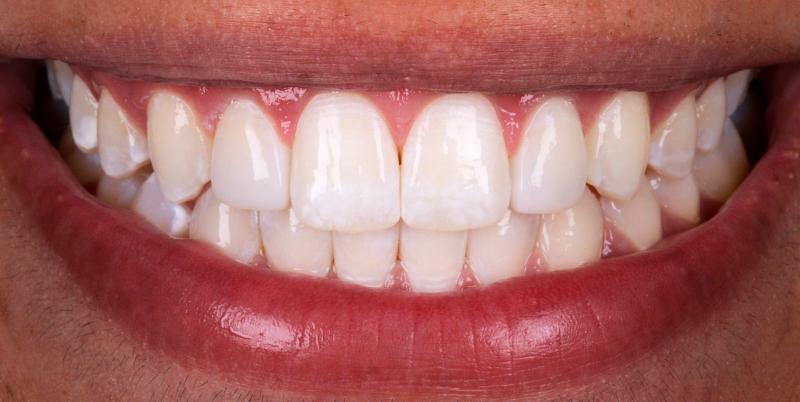 After -Chatham Dental