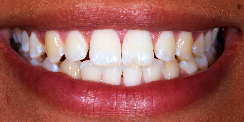 Before - Chatham Dental