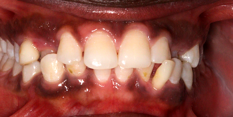 Before - Chatham Dental