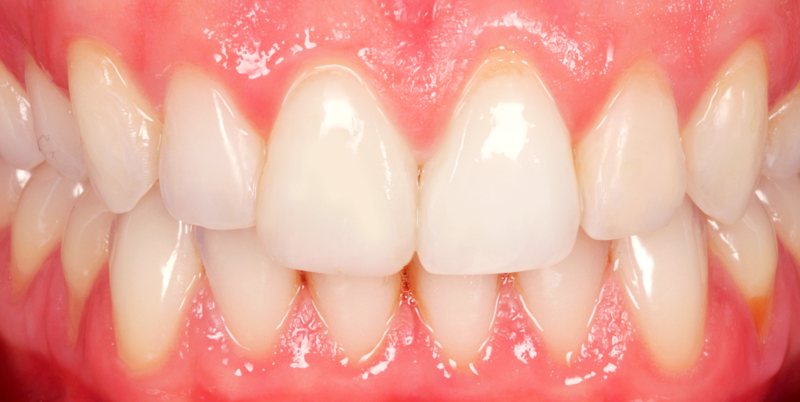 After -Chatham Dental