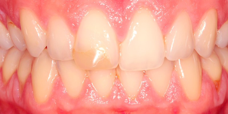 Before - Chatham Dental