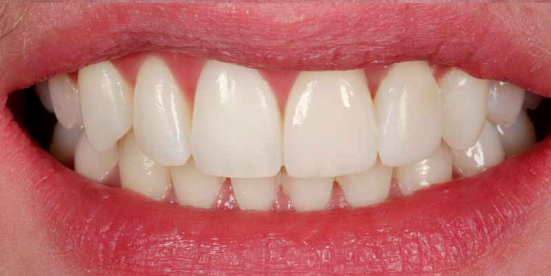 After -Chatham Dental