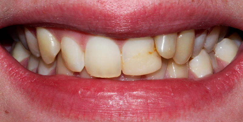Before - Chatham Dental