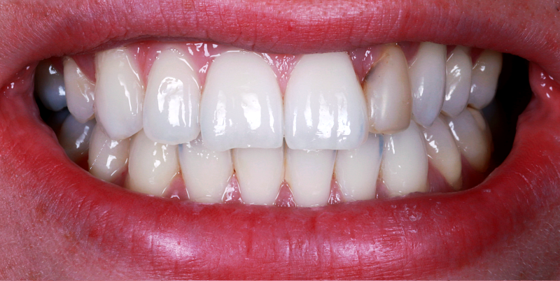 Before - Chatham Dental