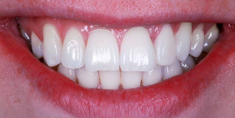 After -Chatham Dental